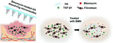 Graphical abstract: Enhanced in vitro efficacy for inhibiting hypertrophic scar by bleomycin-loaded dissolving hyaluronic acid microneedles